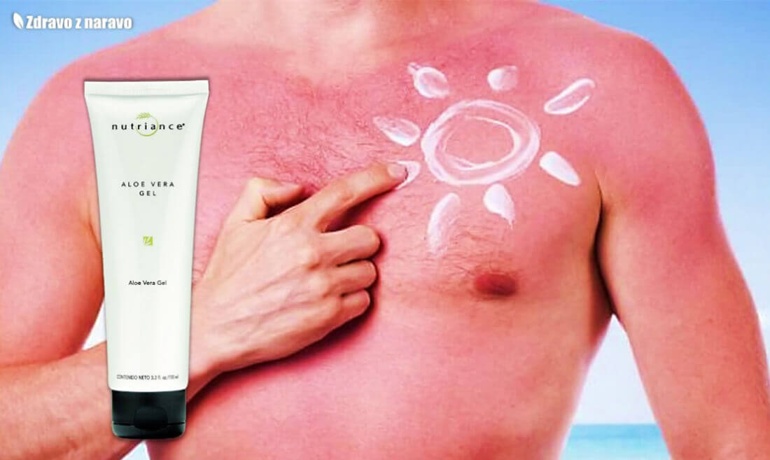 Moški na plaži s pordelo kožo