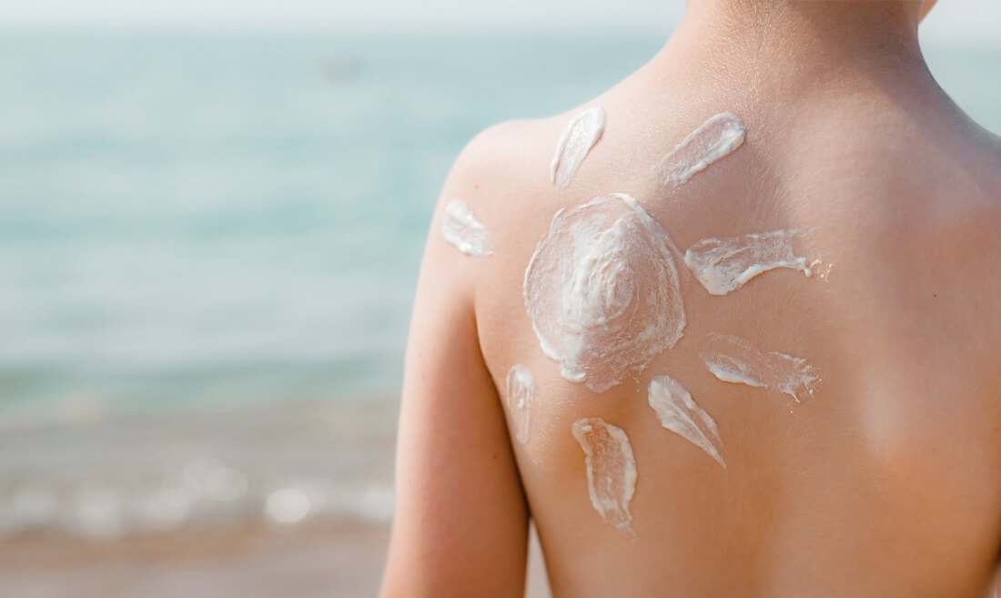 Otrok na plaži s pordelo kožo